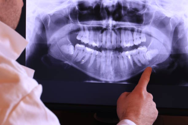Best Walk-In Emergency Dental Services in White City, UT