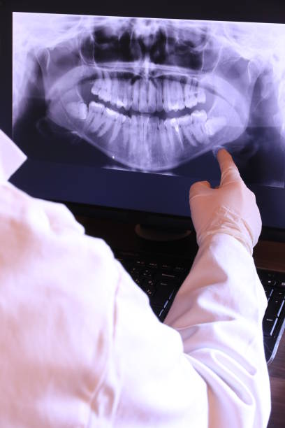 Best Broken or Chipped Tooth Repair in White City, UT